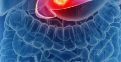 Ilmuwan Jerman Berhasil Membuat Vaksin untuk Jenis Kanker Mematikan Ini