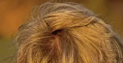 Tidak Hanya Kulit di Wajah dan Tubuh, Kulit Kepala juga Bisa Alami Penuaan!