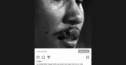 Bibir Robek Saat Final SEA Games 2023 Lawan Thailand, Tompi Tawarkan Bantuan Operasi untuk Bagas Kaffa