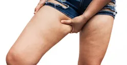 Paha besar (Sumber : Pexels)