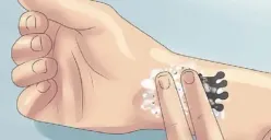 Tato yang Dihapus Berbekas? Begini Tips Menghilangkannya
