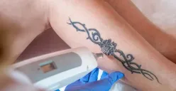 Cara menghapus tato yang aman menurut medis, jangan asal pilih! (Sumber : Hello Sehat)