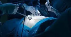 19 Operasi yang Ditanggung BPJS Kesehatan, Berobat Bisa Gratis tanpa Biaya