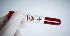 Ilustrasi |  Jumlah penderita HIV/AIDS di Demak hingga September 2023 sebanyak 847 orang, 155 diantaranya usia remaja. (Sumber : Stockphoto)