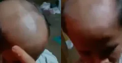 Terjadi Lagi! Guru Botaki Siswa SMP , Tega Sisakan Sedikit Rambut di Samping hingga Tampilannya Mirip Badut