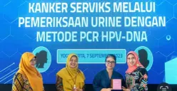 Pemda DIY-PT Bio Farma Luncurkan Program Deteksi Dini Kanker Serviks