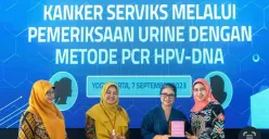 Peluncuran program pemeriksaan urine dengan metode PCR HPV-DNA di Balai Laboratorium Kesehatan dan Kalibrasi (BLKK) DIY.