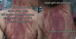 PARAH! Viral Bayi Dikerok Pengasuh Sampai Menangis Histeris, Bagian Punggung Memerah Bikin Publik Tak Tega