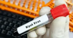 Cara Pemerintah India Cegah Penyebaran Virus Nipah, Seperti Apa Gejalanya? (Sumber : Freepik)