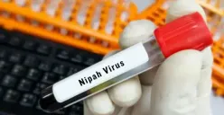 Cara Pemerintah India Cegah Penyebaran Virus Nipah, Seperti Apa Gejalanya?