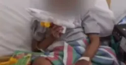 Kondisi korban penganiayaan satu keluarga di Kota Malang, DN bocah laki-laki berusia 7 tahun (Sumber : YouTube TvOneNews)
