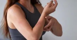 ilustrasi : tubuh memar tanpa sebab bisa karena penyakit ini (Sumber : freepik)