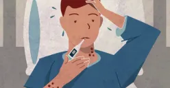 Laporan harian cacar monyet sebanyak 24 kasus Mpox tersebar di Jakarta, Banten, dan Jawa Barat. (Sumber : cdc.gov)