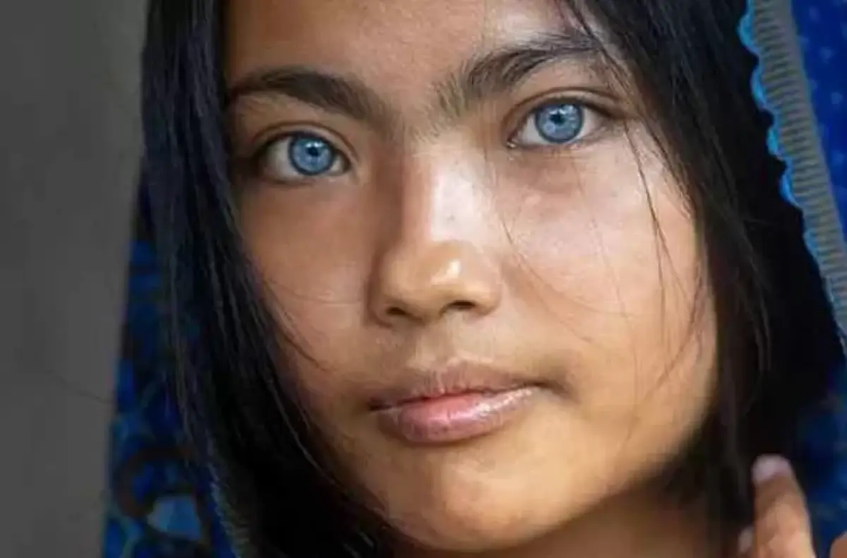 Evi remaja asal Jawa Barat yang memiliki mata biru. (Sumber : Instagram @imperfectframe)