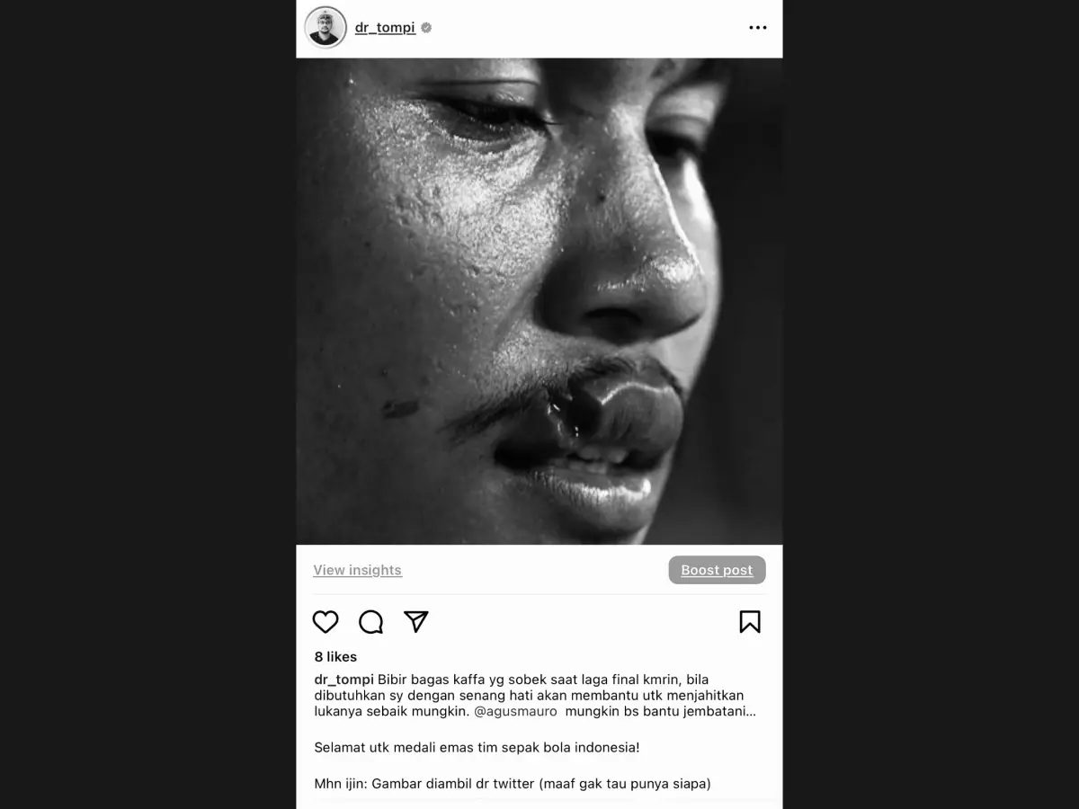 Tompi tawarkan bantuan operasi untuk Bagas Kaffa. (Sumber : Twitter/dr_tompi)