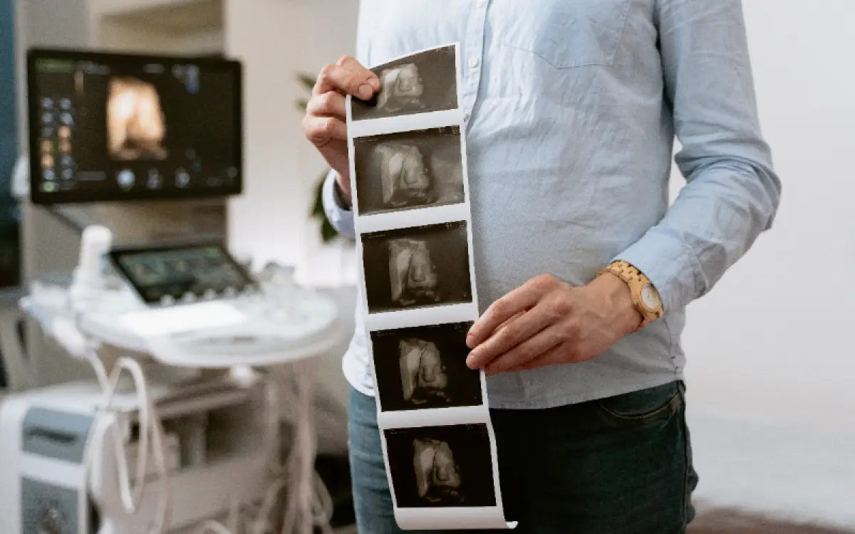 Ilustrasi | Dinkes Kota Semarang siapkan layanan USG gratis di Puskesmas. (Sumber : Pexels @MART PRODUCTION)