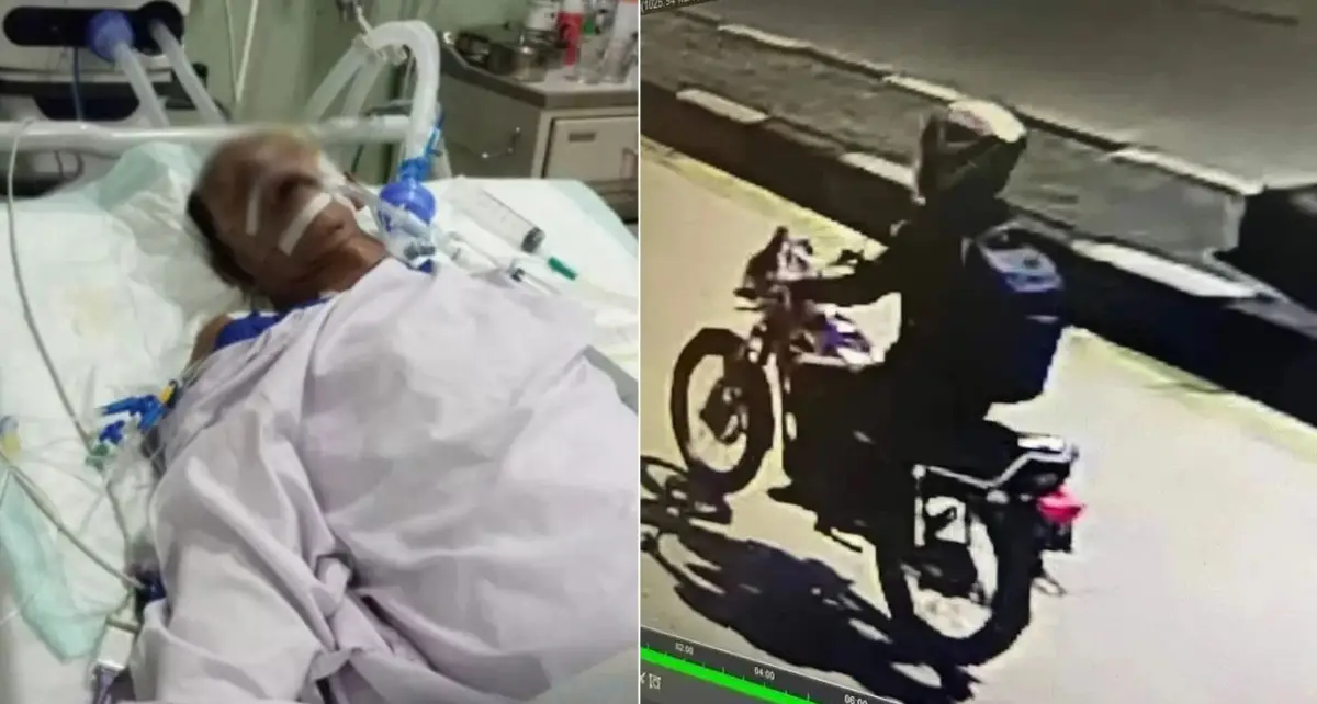 Kondisi terkini korban tabrak lari di Jalan Pantura Sayung Demak-Semarang masih belum sadarkan diri sejak 29 Juni 2023. (Sumber : Instagram @infokejadian_genuk)