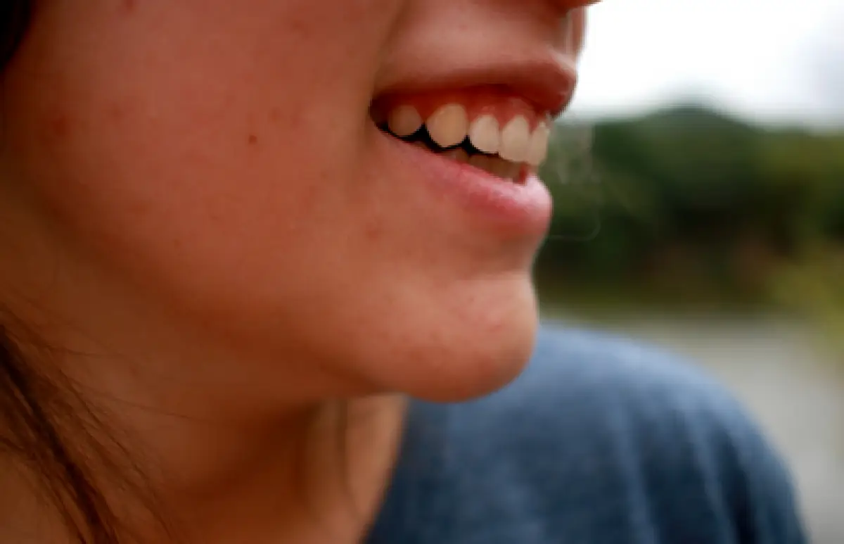 Ilustrasi double chin (Sumber : Pixabay)