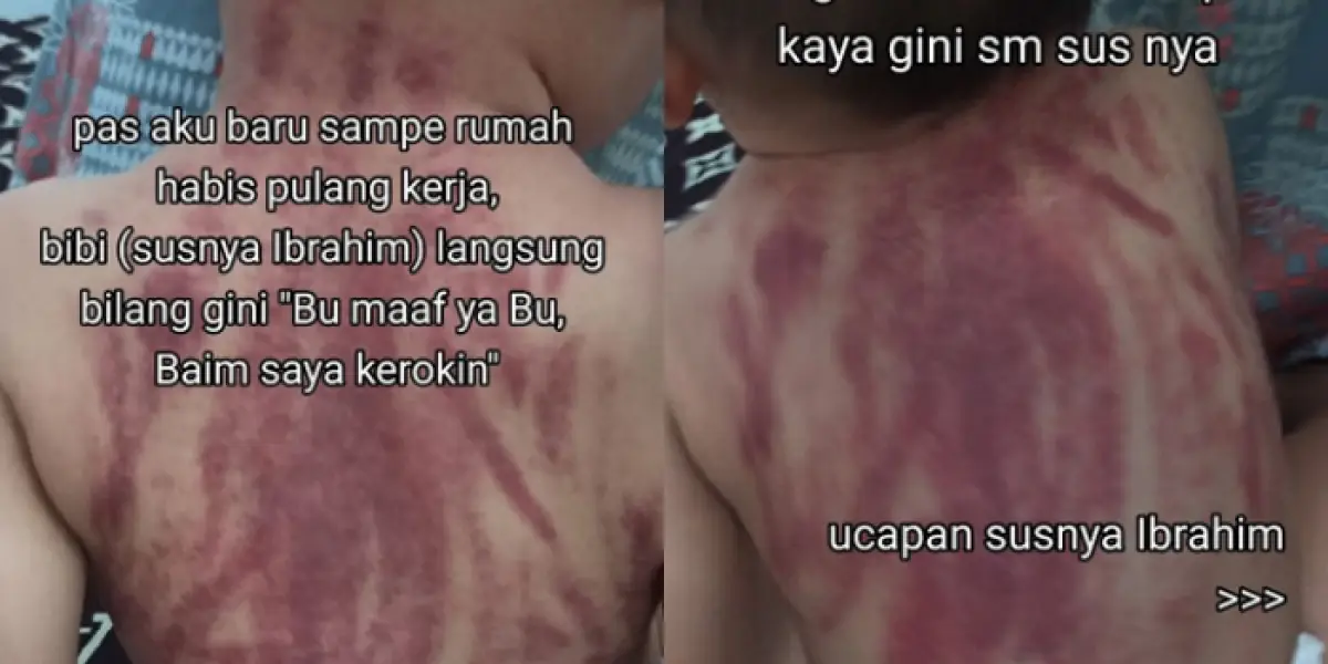 PARAH! Viral Bayi Dikerok Pengasuh Sampai Menangis Histeris, Bagian Punggung Memerah Bikin Publik Tak Tega (Sumber : TikTok/@tia.rochman)