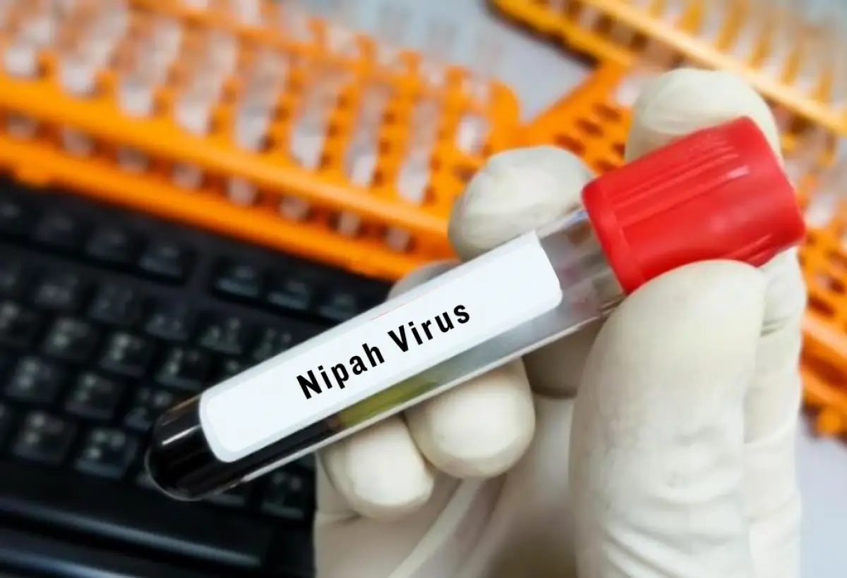 Cara Pemerintah India Cegah Penyebaran Virus Nipah, Seperti Apa Gejalanya? (Sumber : Freepik)
