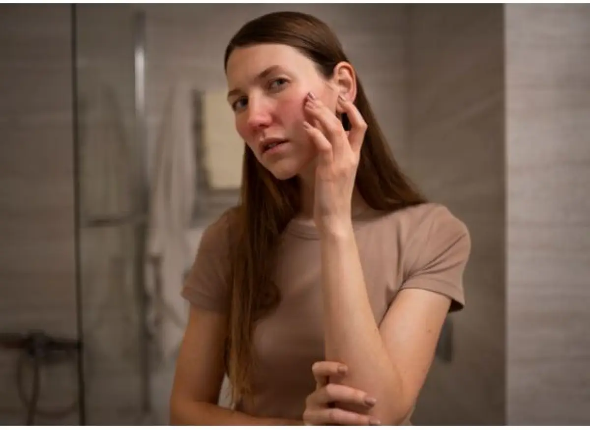 ilustrasi : cara menghilangkan bekas luka hitam dengan bahan alami (Sumber : freepik)