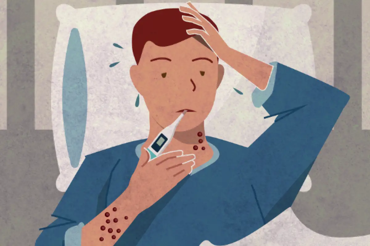 Laporan harian cacar monyet sebanyak 24 kasus Mpox tersebar di Jakarta, Banten, dan Jawa Barat. (Sumber : cdc.gov)