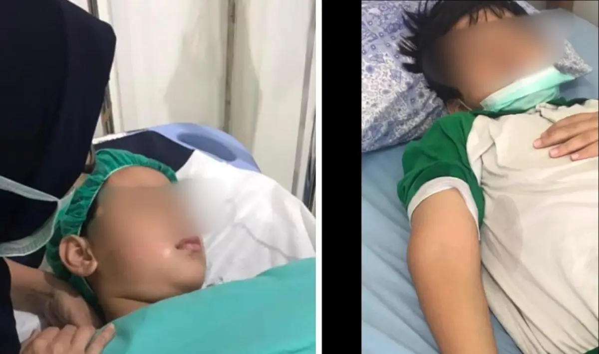 Mellisa Anggraini sebut Leon memberi kesaksian bahwa gurunya membuat skenario tutupi kasus bullying yang membuat lengannya patah. (Sumber : Facebook Dudy Syahprialdi)