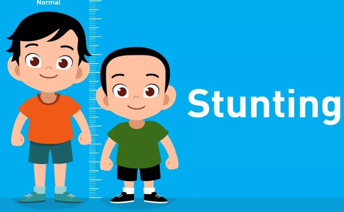 ilustrasi : Anak normal dan stunting (Sumber: siloamhospital.com | Foto: infosemarang.com )